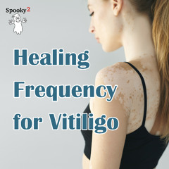 Healing Frequency for Vitiligo-Spooky2 Rife Frequencies