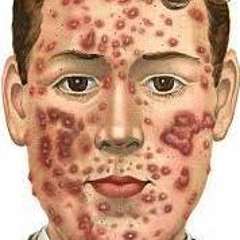 ANOTHER DAY, ANOTHER PUSTULE