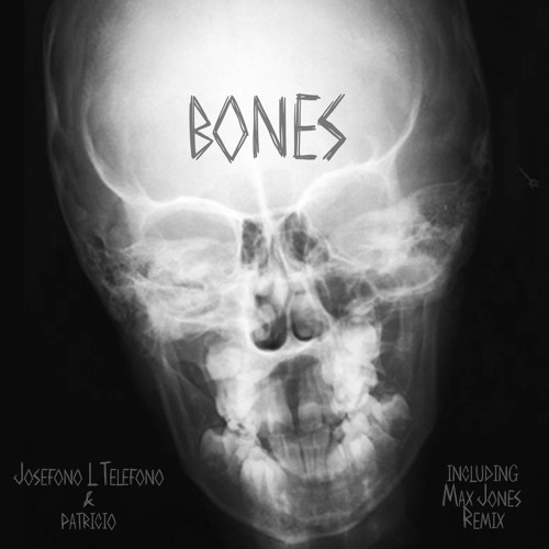 Josefono L Telefono & Patricio - Bones (Max Jones Remix)