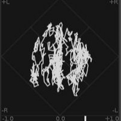 Precious Little Time