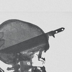 Psychosis - x-ray