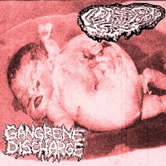 FETAL DEFORMITY- GANGRENE DISCHARGE SPLIT (FETAL DEFORMITY SIDE)