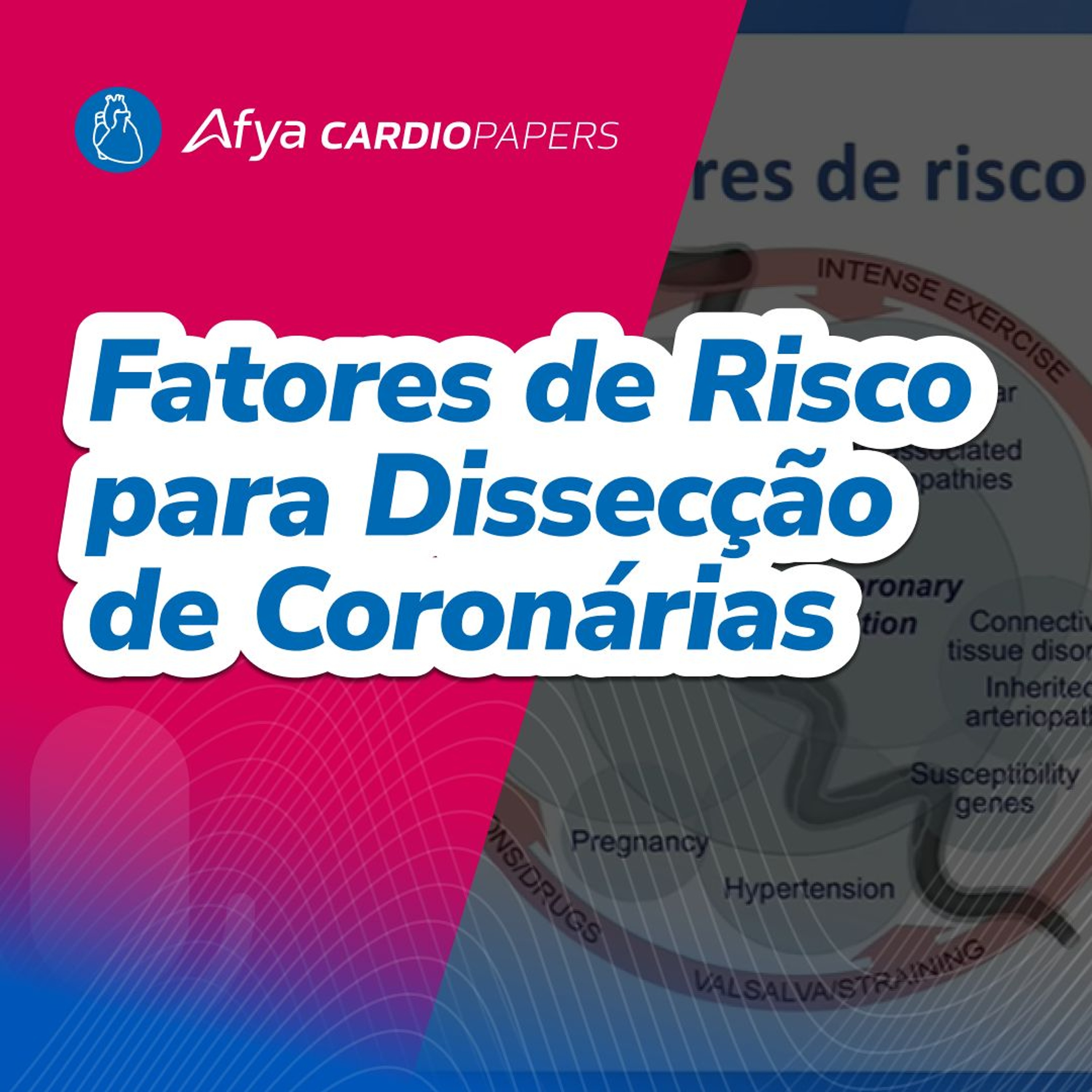 Fatores de risco para dissecção de coronárias episode artwork
