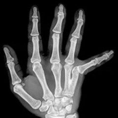 BROKEN HAND SKANK | DNB MIX