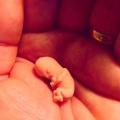 Embryo (Psalm 139:14-18)