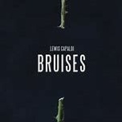 Bruises- Lewis Capaldi(Remix)