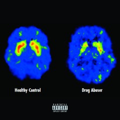 me siento loco (prod.dying youth)