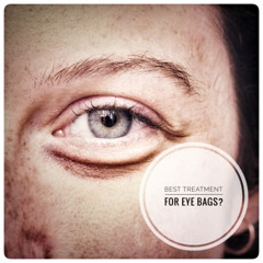 Best Eye Bags Treatment Reviews