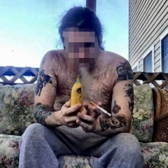 Burn Victim With Banana? (TV-53 inSAnE)