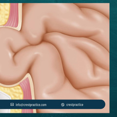 Hernia Care: Daily Habits & Treatment Options