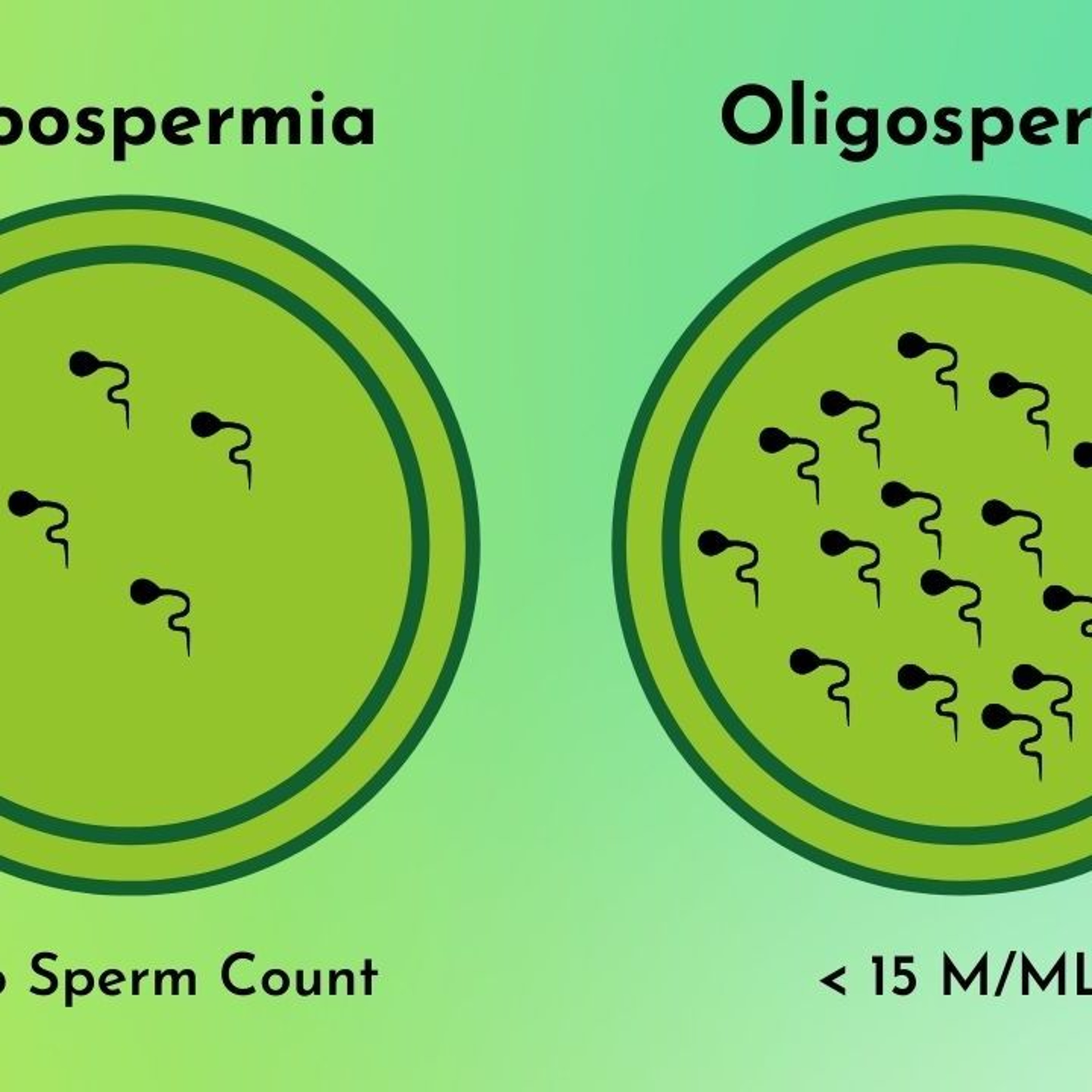 Azoospermia Treatment Ayurveda episode artwork