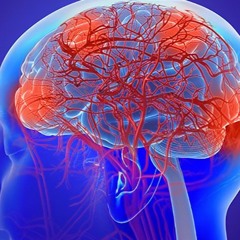 Dr Joel Wallach On Kidney Disease, Dialysis And Vascular Dementia