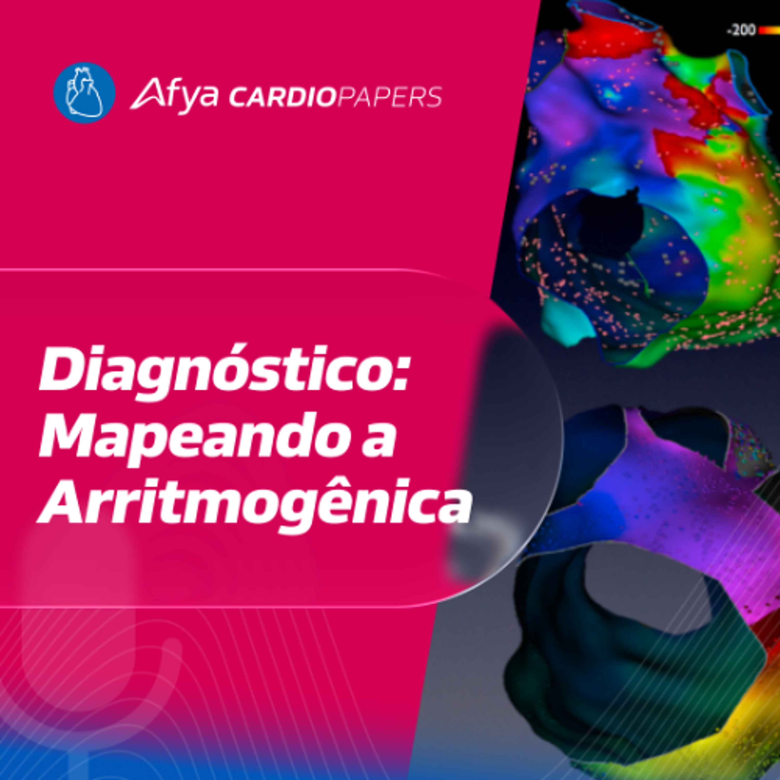 Diagnóstico da Cardiomiopatia Arritmogênica de Forma Simplificada
