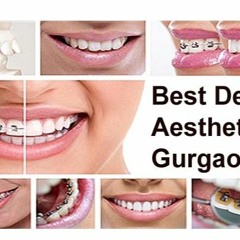 Painless  Root Canal Treatment And Dentistry in Gurgaon