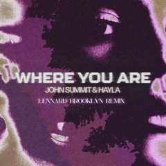 Where You Are (Lennard Brooklyn Remix)