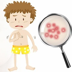 चिकन पॉक्स(chickenpox) का दाना कब तक बना रहता है