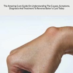 PDF Baker's Cyst: The Amazing Cure Guide On Understanding The Causes, Symptoms,