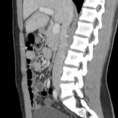 quiero entender - ideas 1