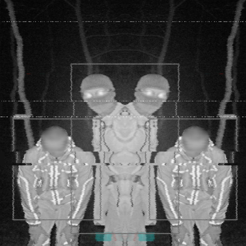 SUDO - HI IM SUDO! [Odium Edit]