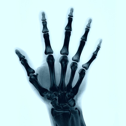 Previews | VOIDWARE004