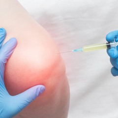 Could R399E Become a Promising Treatment for Restoring Joints and Relieving Pain in Osteoarthritis?