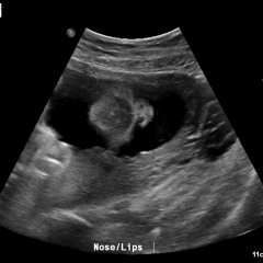 can't you see By; kenishafineasf