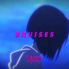 [SAD] RUZLXN X ALT ROCK TYPE BEAT "BRUISES"