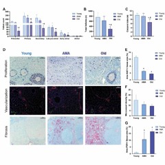Deciphering Reproductive Aging in Women Using a NOD/SCID Mouse Model