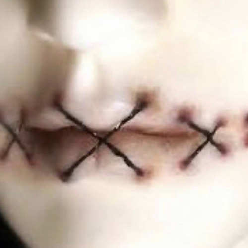 1st snippet >.<