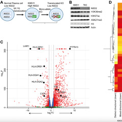 NSD2 Gene Drives Cancer Cell Identity in Multiple Myeloma