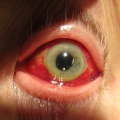GOING, GONE! [red eyes demo]