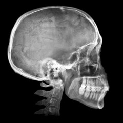 xray [prod. zardman]