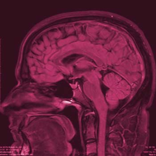 DAS SYNDROM