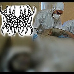 DxBxAxIxRxHxF - Obese Bloated Body Putrefaction