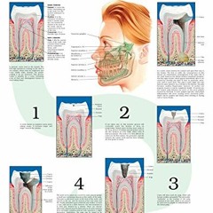 [Read] PDF EBOOK EPUB KINDLE Tooth decay e chart: Full illustrated by  HC-HealthComm