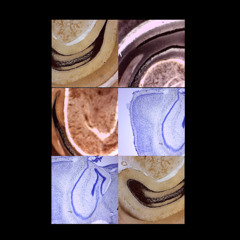 Fine Grain