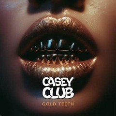 Redlight - Gold Teeth (Casey Club Dubstep Bootleg) FREE DL