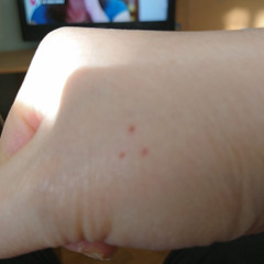 Segulah, segol or sign of a mothership on my body ?