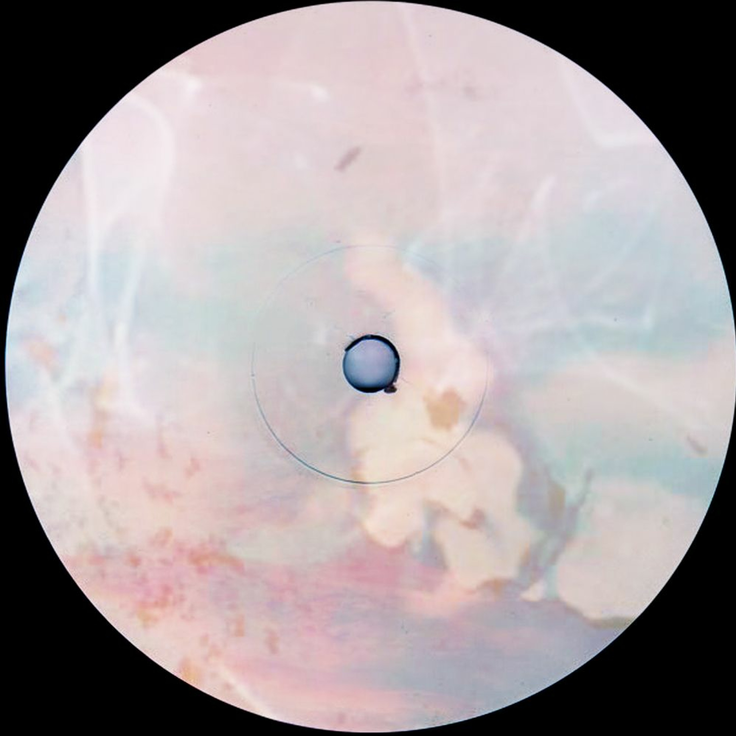 Four Four Premiere: Son Orbis - Blem episode artwork