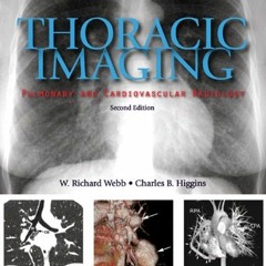 [GET] EPUB KINDLE PDF EBOOK Thoracic Imaging: Pulmonary and Cardiovascular Radiology by  W. Richard