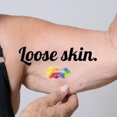 #300 Lets talk "Loose Skin".
