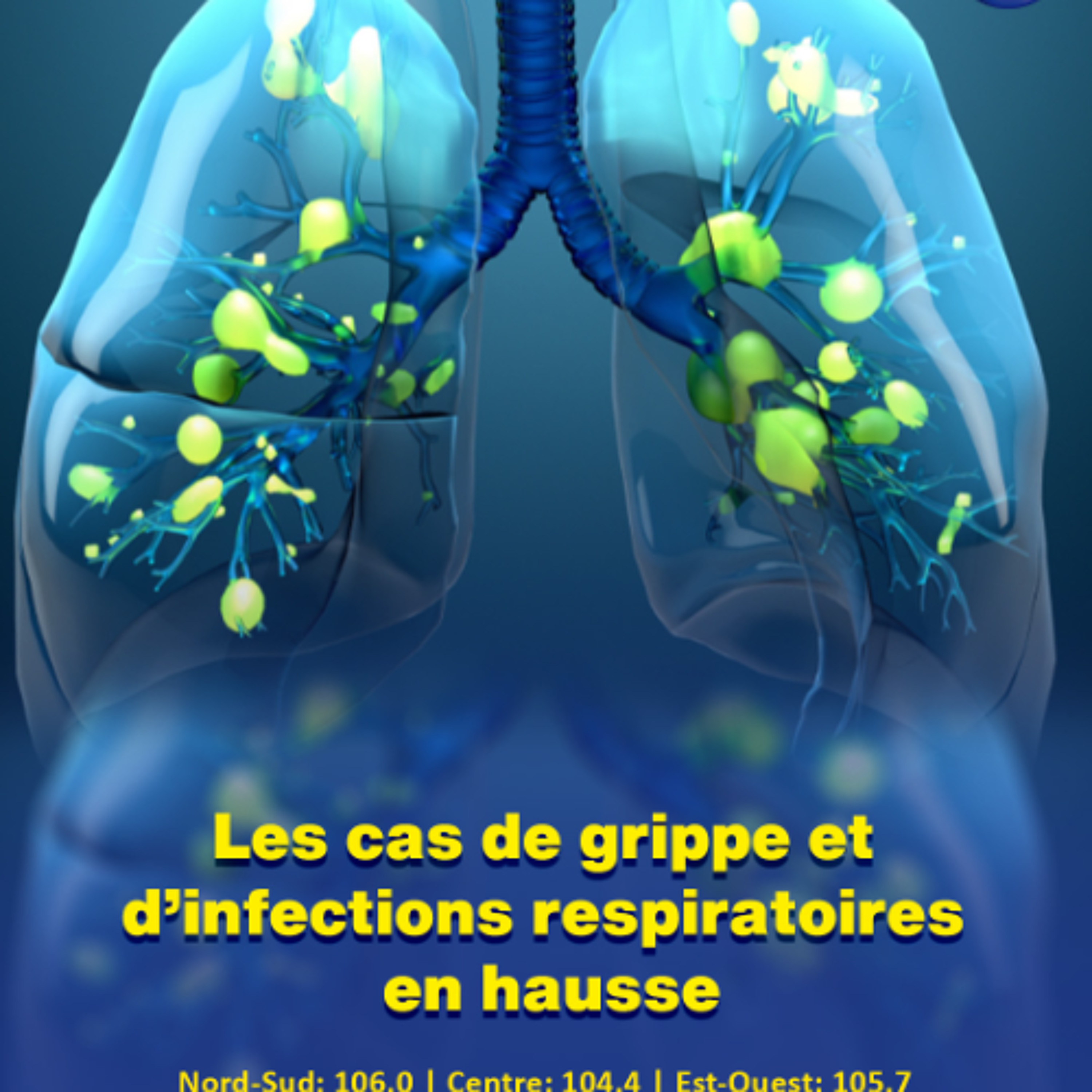 Les cas de grippe et d’infections respiratoires en hausse