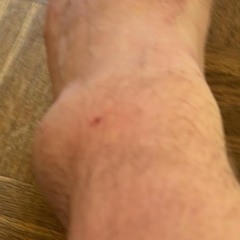 Mikkel elsker de gule og de blå