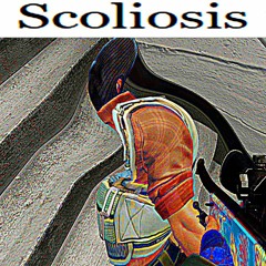 scoliosis [extended]