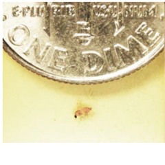 Ceratopogonidae Otoacoustique