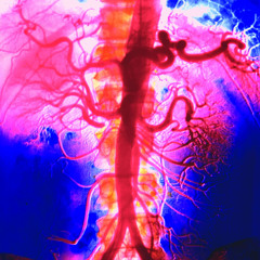 human organism