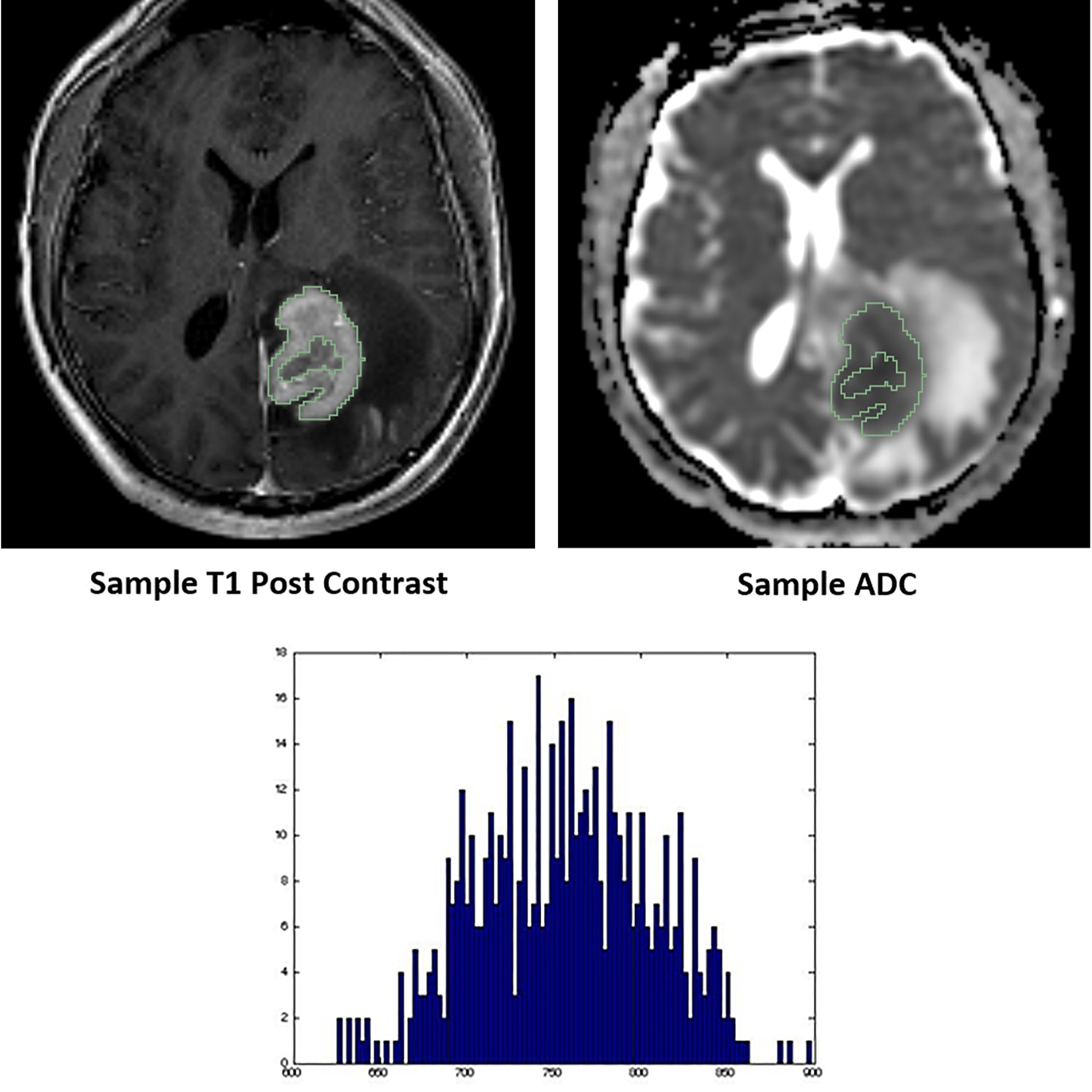 Oncotarget