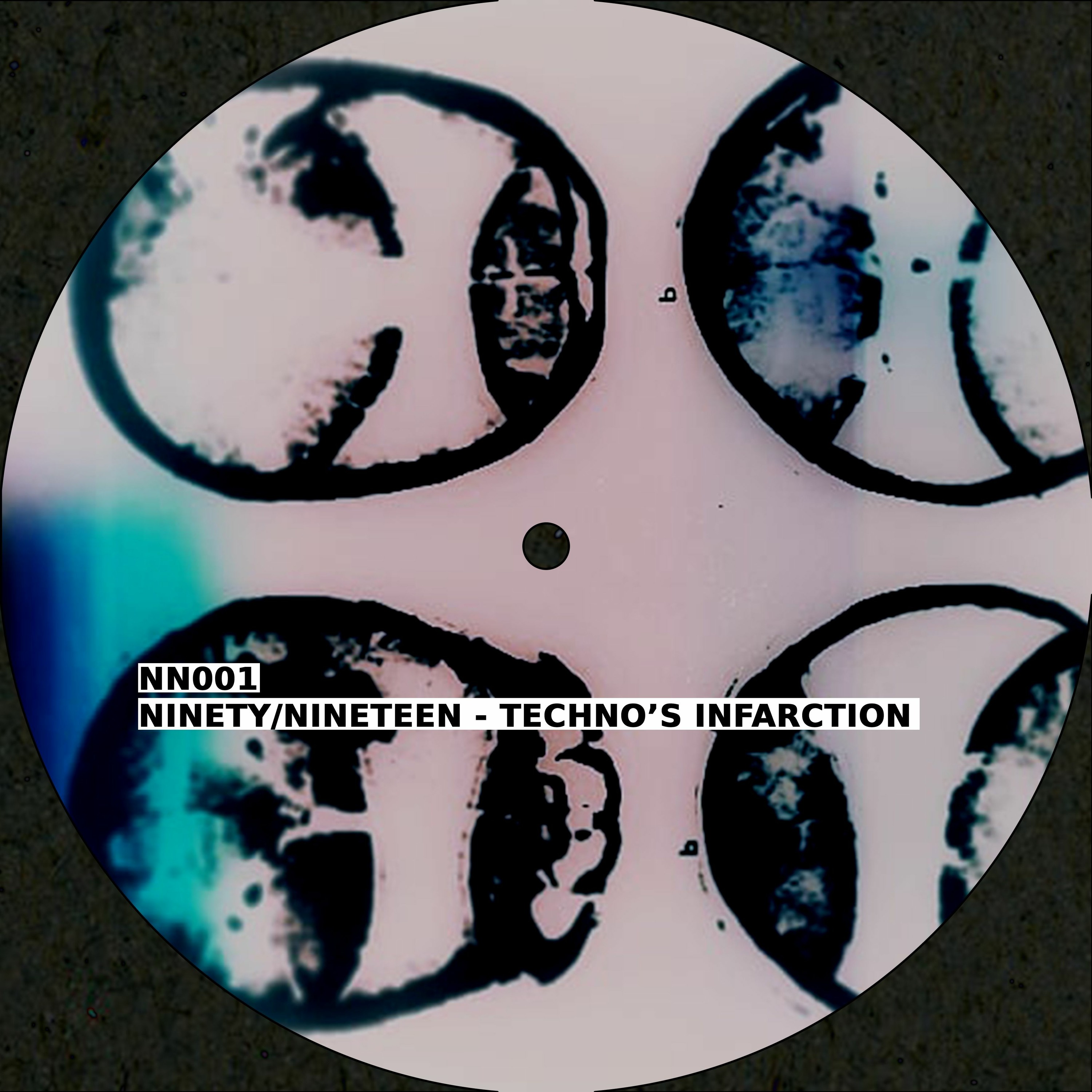 TECHNO'S INFARCTION episode artwork