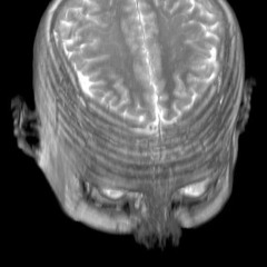 DOLI - ŁAPA prod. metlast