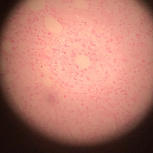 almost like it never happened